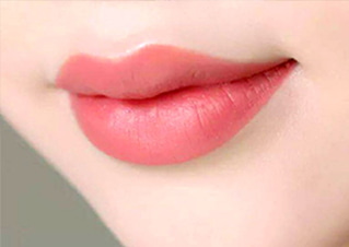 Phun Môi Collagen
