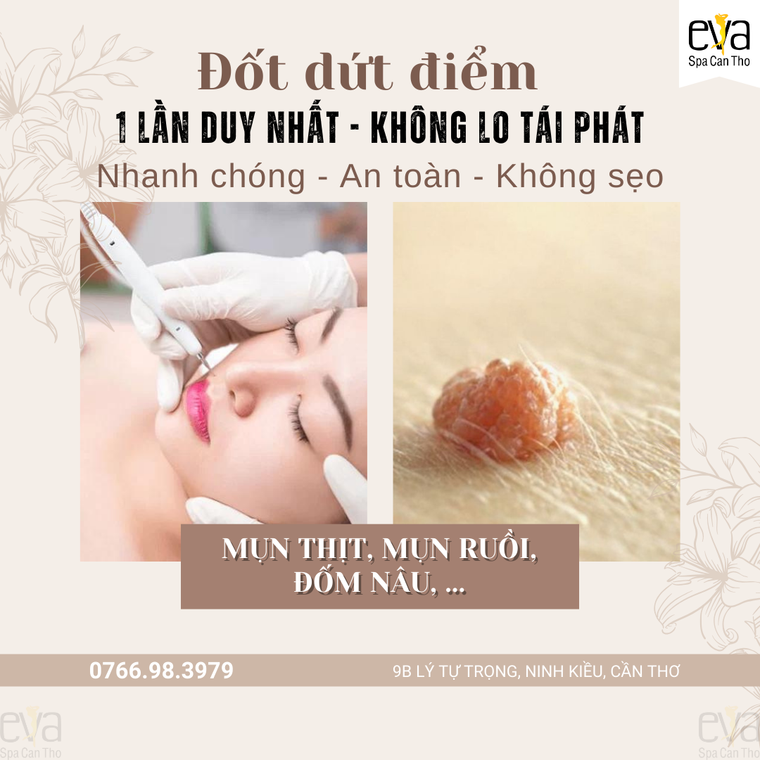 Đốt Mụn Thịt, Mụn Ruồi, Đốm Nâu, ...