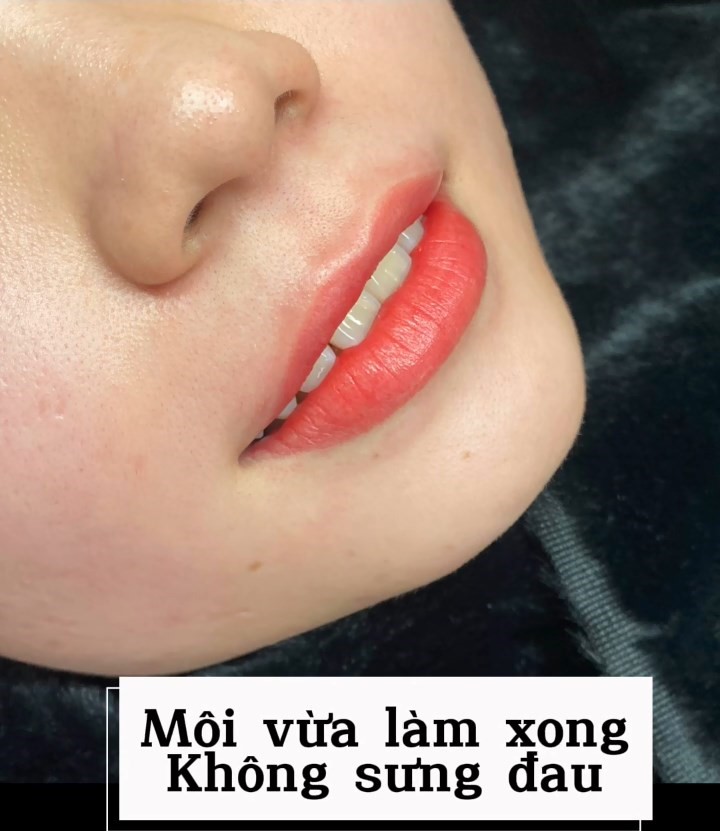 Môi thâm, nhợt nhạt, không đều màu, ... Đến Eva Spa nhé !!!