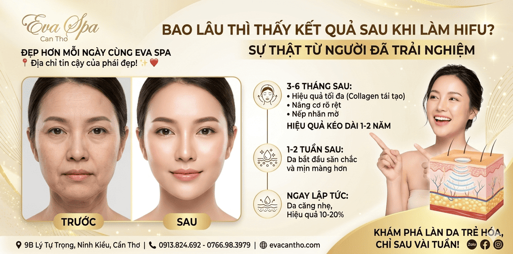 Bao lâu thì thấy kết quả sau khi làm HIFU?