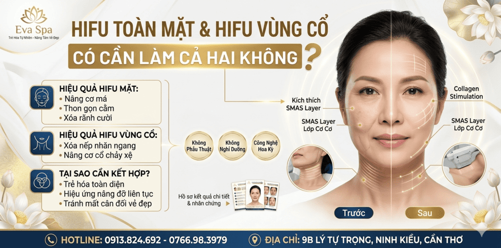 HIFU toàn mặt và HIFU vùng cổ – Có cần làm cả hai không?