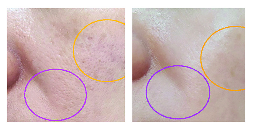 CELLULAR EXOSOME ELIXIR Rx, 1 Hộp (2*5ml)