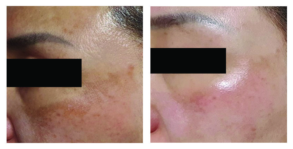 CELLULAR EXOSOME ELIXIR Rx, 1 Hộp (2*5ml)