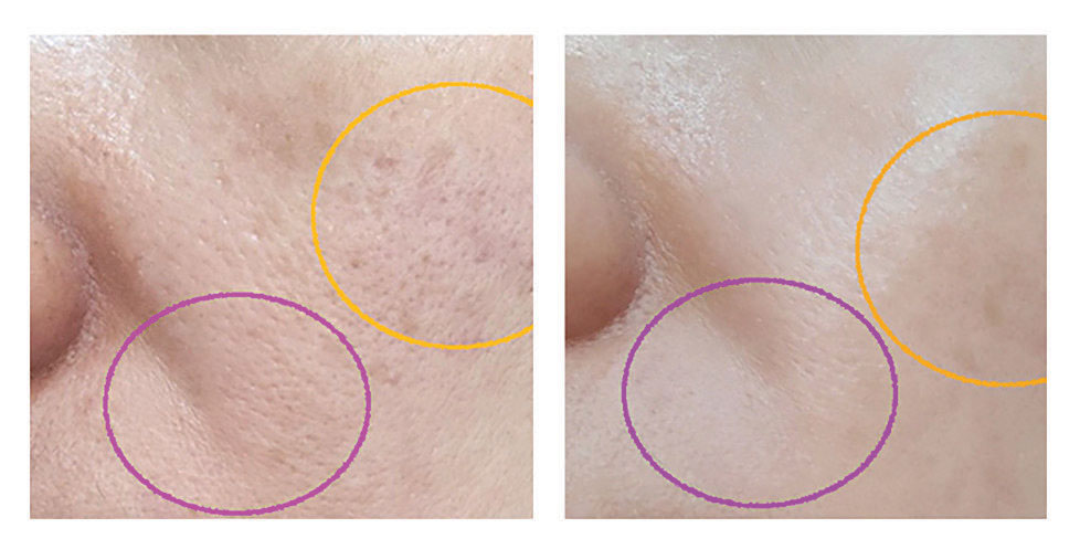 Tinh Chất Làm Trắng Da, Trẻ Hóa & Cải Thiện Nếp Nhăn Danique Cellular Exosome Elixir Rx 5ml*2 vials