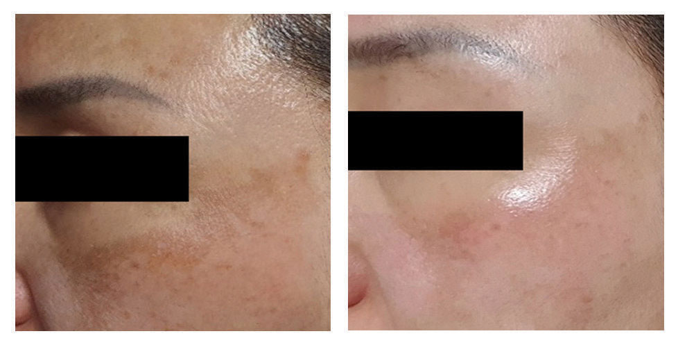 Tinh Chất Làm Trắng Da, Trẻ Hóa & Cải Thiện Nếp Nhăn Danique Cellular Exosome Elixir Rx 5ml*2 vials